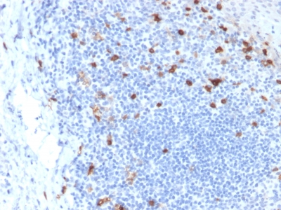 Formalin-fixed, paraffin embedded human tonsil sections stained with 100 ul anti-CD103 (clone ITGAE/2063) at 1:100. HIER epitope retrieval prior to staining was performed in 10mM Citrate, pH 6.0.